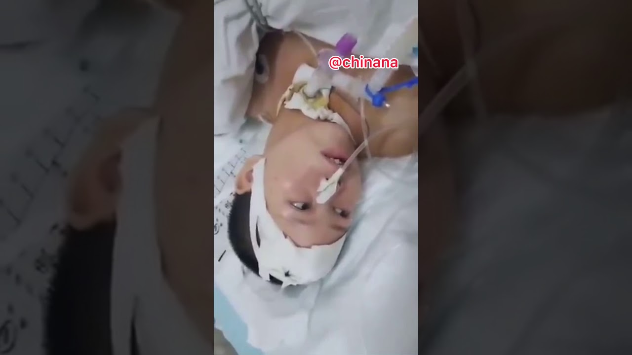 下顎呼吸の動画 画像 動画検索 マイルドサイト 下顎呼吸の動画 画像 動画検索 マイルドサイト